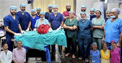 सफदरजंग अस्पताल में 10.6 किलोग्राम का विशाल गैस्ट्रोइंटेस्टाइनल स्ट्रोमल ट्यूमर सफलतापूर्वक निकाला गया