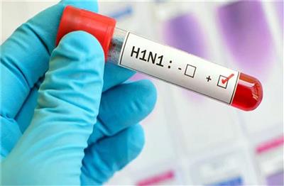 टांडा के बाद अब IGMC शिमला में स्वाइन फ्लू की दस्तक, 2 मरीज मिले संक्रमित