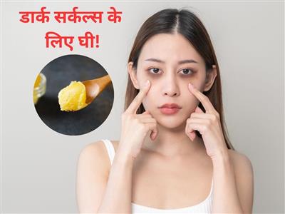 आंखों के नीचे काले घेरे हैं? घी में मिलाकर लगाएं बस ये 1 चीज
